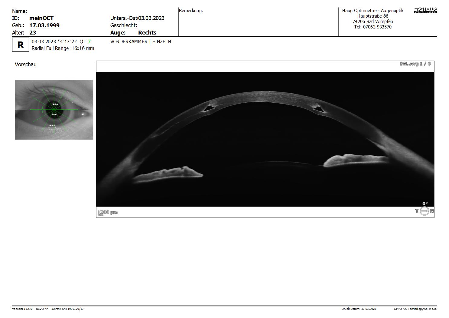meinOCT___20230303_141722_Vorderkammer_Radial_Full_Range_R_EINZELN_16mm_8192x6x3_REPORT.jpg