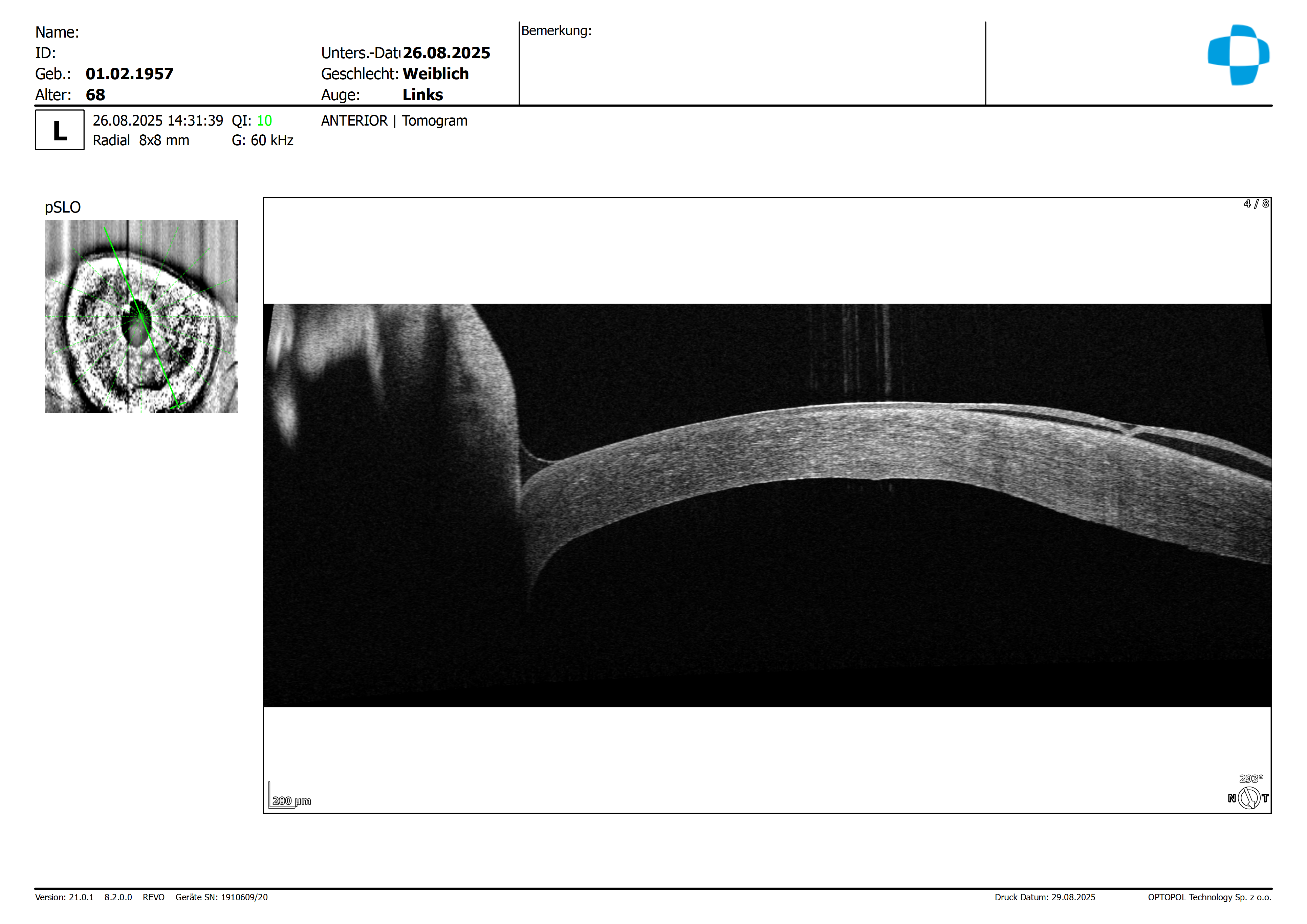 20250826_143139_Anterior_Radial_L_Tomogram_8mm_2560x8x3-1.png