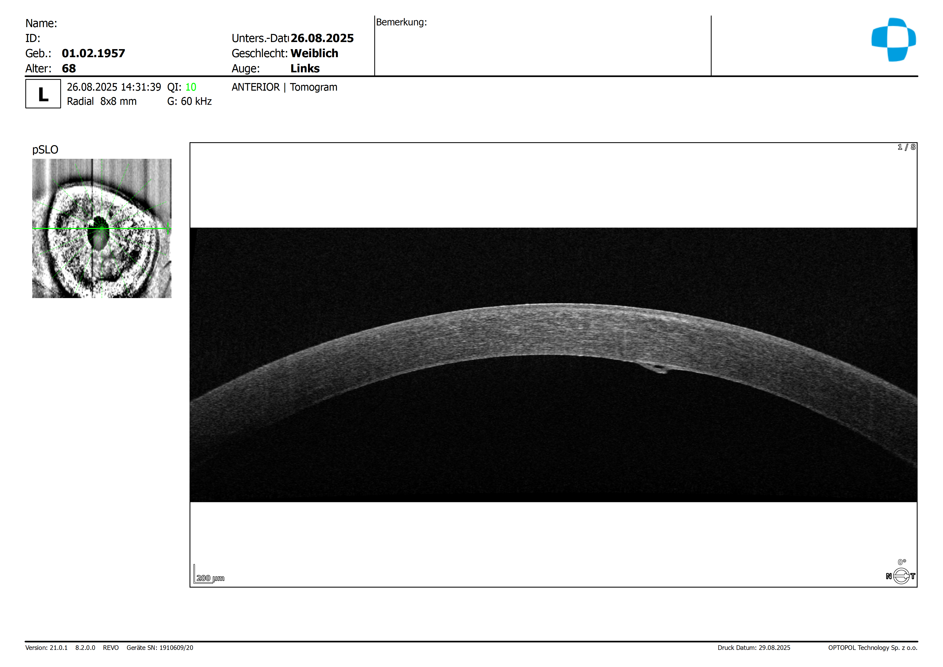 20250826_143139_Anterior_Radial_L_Tomogram_8mm_2560x8x3.png