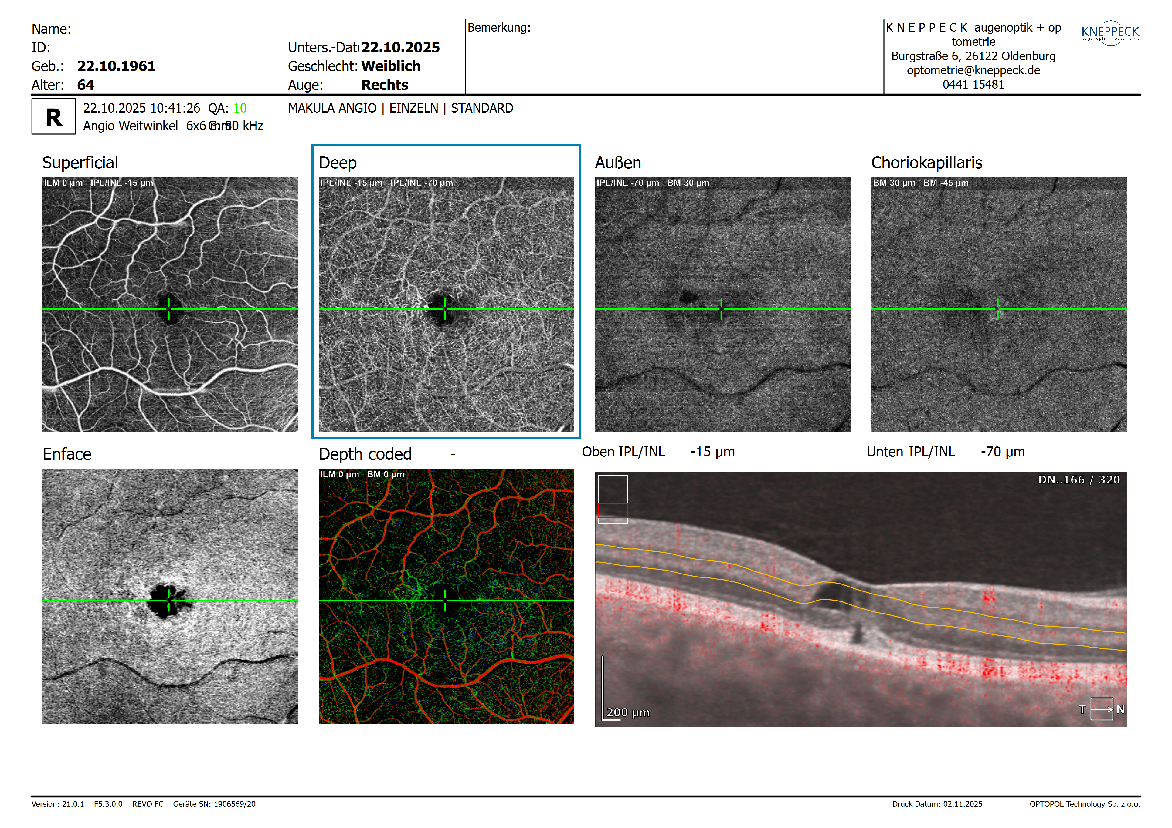20251022_104126_Makula_Angio_Weitwinkel_R_EINZELN_6mm_320x320.png