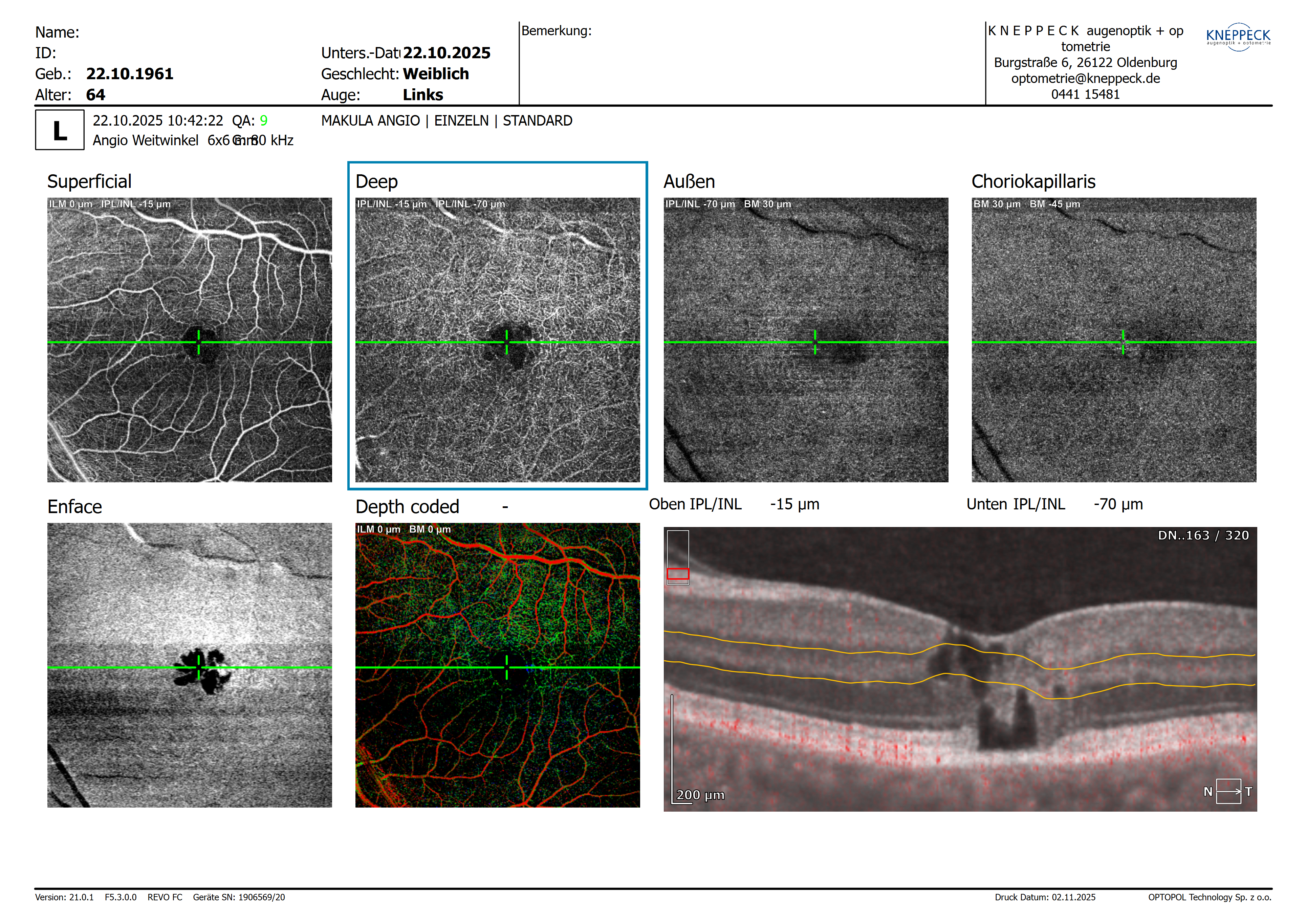 20251022_104222_Makula_Angio_Weitwinkel_L_EINZELN_6mm_320x320.png