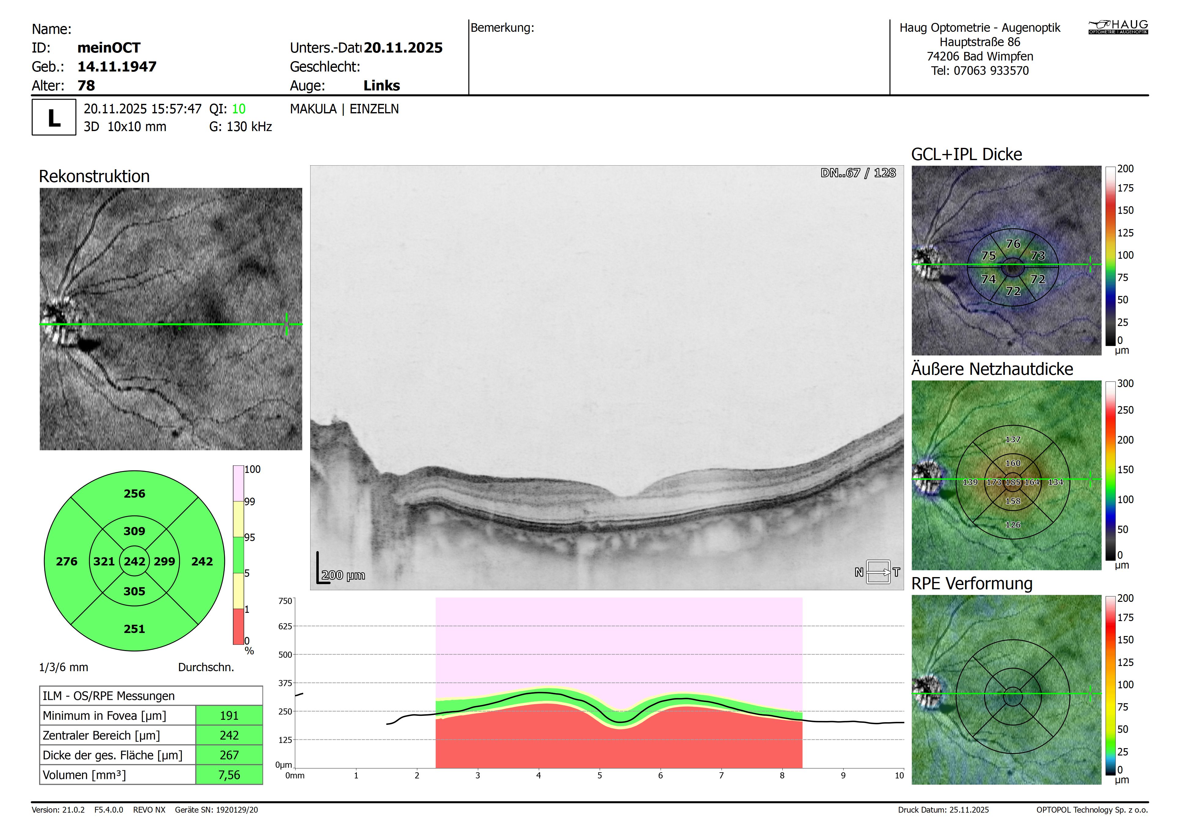 meinOCT___20251120_155747_Makula_3D_L_EINZELN_10mm_1024x128_REPORT.jpg