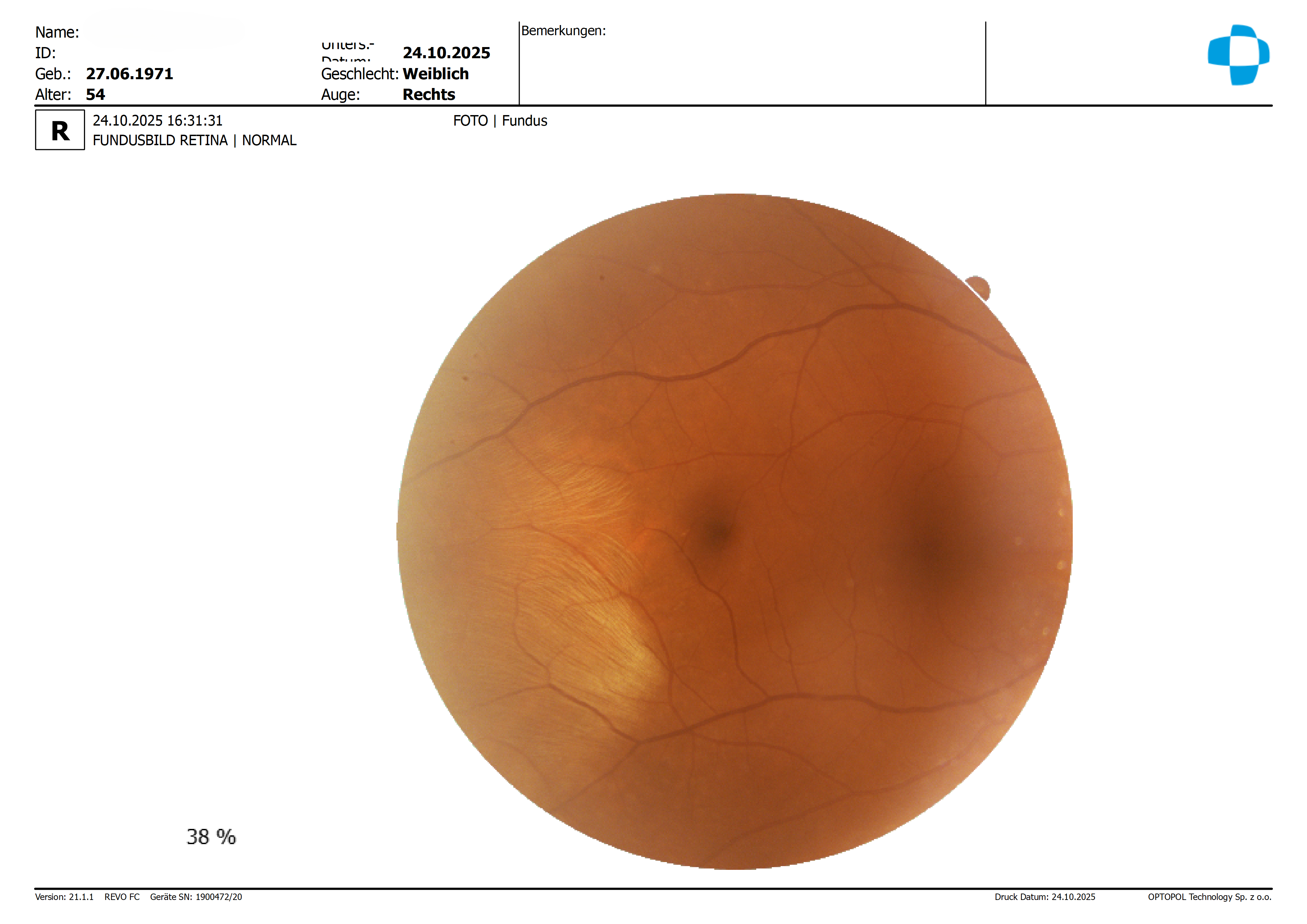 PK-20251024_163131_R_Fundus.png