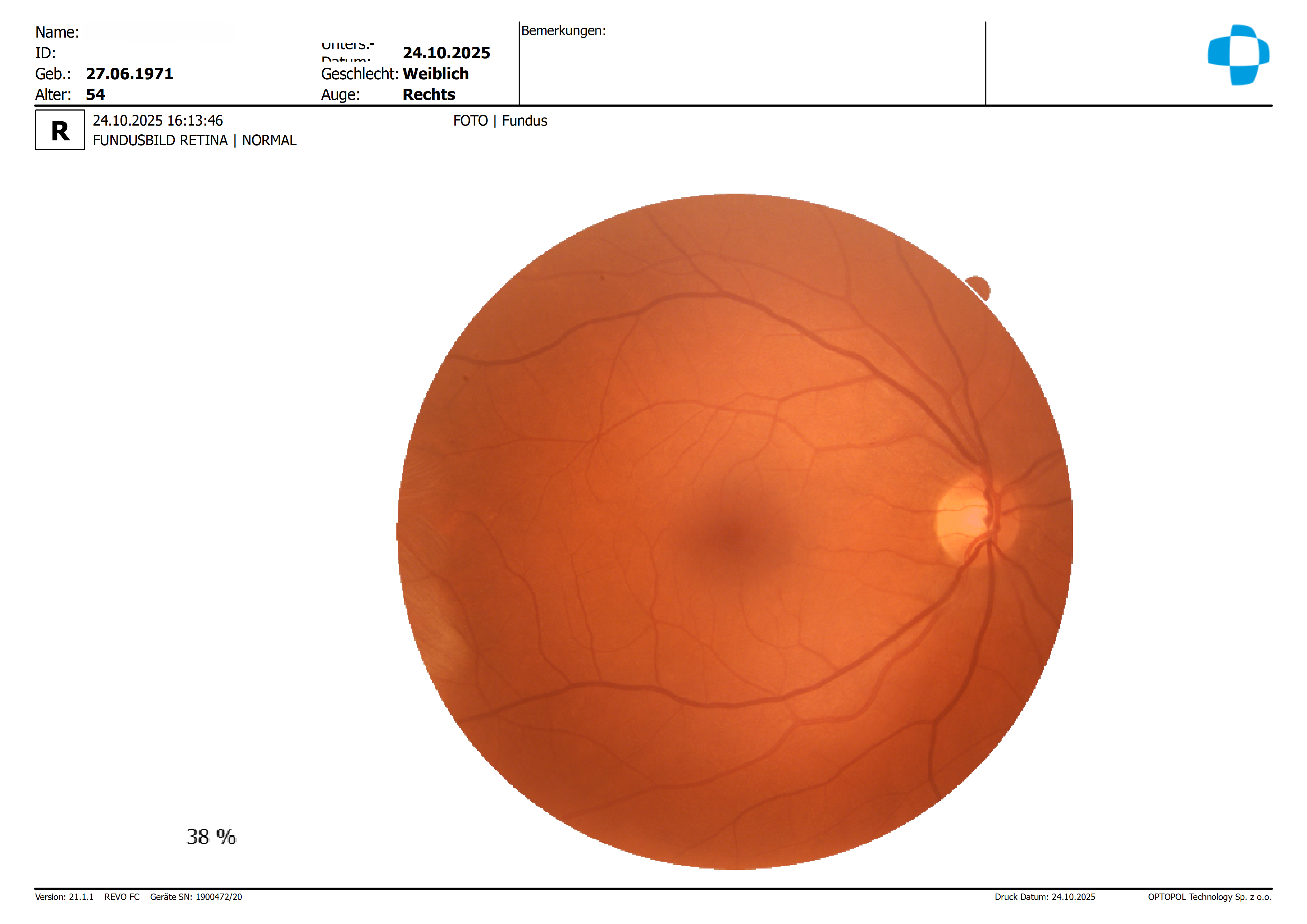 PK__20251024_161346_R_Fundus.png